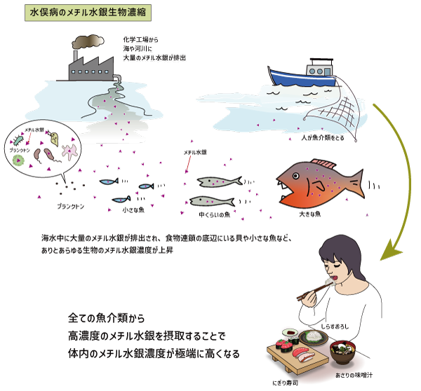 脳について学ぼう Minamata Disease