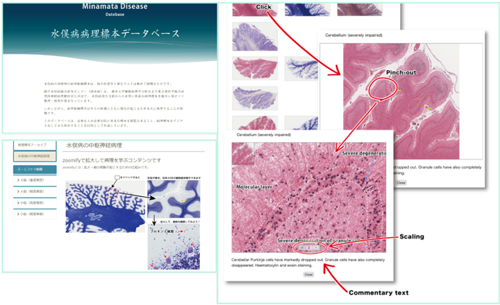 病理標本の活用